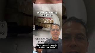 Professional Teeth Whitening vs Hydrogen Peroxide EXPLAINED  In Office to Hands On Dental Training [upl. by Alvarez]