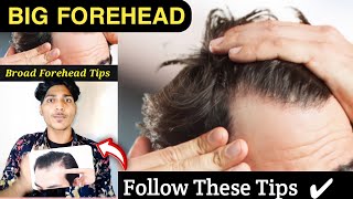 Big Forehead Tips  Receding Hairline  shorts  Big Forehead Hairstyles  ytshorts hairloss [upl. by Anyad433]