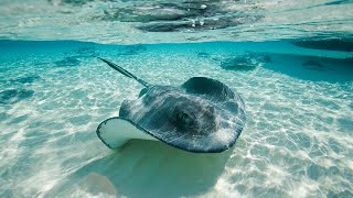 Florida woman recovering from stingray attack shares experience Thought I was going to die [upl. by Annez]