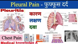 Pleuralpain  pleuraltitis संक्रमण के कारण और उपचार Chest pain in hindi फुफ्फूशीय दर्दnursing [upl. by Gwenette]