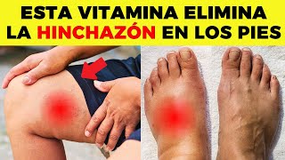 ESTA es LA MEJOR VITAMINA para ELIMINAR la HINCHAZÓN en PIES y PIERNAS [upl. by Yvad]