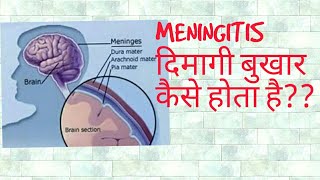 Meningitis in hindi [upl. by Herbie]