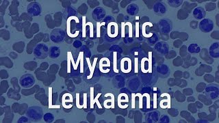 Chronic myeloid leukaemia [upl. by Riancho735]