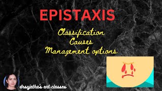 250EpistaxisClassificationCauses Diagnosis and Management plans [upl. by Blackburn]