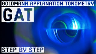 Goldmann applanation Tonometry GAT  basic STEP BY STEP GUIDE [upl. by Maire571]