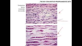 Tecidos conjuntivos  parte 5 [upl. by Luedtke]