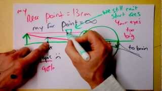 Optometry 101  Corrective Optics for Myopic and Hyperopic Vision  Doc Physics [upl. by Sidwohl]