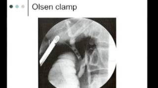 IntraOperative Imaging of the biliary system  Cholangiography [upl. by Anec]