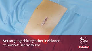 Leukoplast Leukomed T plus skin sensitive – Versorgung chirurgischer Inzisionen [upl. by Rainah]