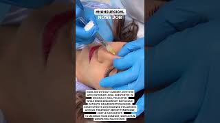 Redefine Your Profile NonSurgical Nose Job with Dermal Fillers at EDEN AESTHETICS Dubai [upl. by Tdnaltroc]