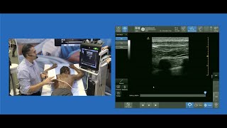 Paramedian Sagittal Approach to Thoracic Paravertebral Block [upl. by Coates]