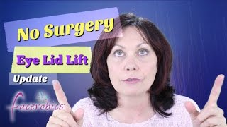 How to Get Rid of Droopy Eye Lids No Surgery Eye Lid Lift Hooded Eye Lid Lift  FACEROBICS® [upl. by Hiltan]