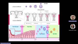 Carcinoma Endometrial Radiologia [upl. by Alaric]