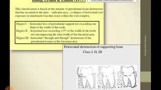 Furcation involvement [upl. by Mathian]