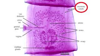 Diphyllobothrium Latum [upl. by Wivinah828]