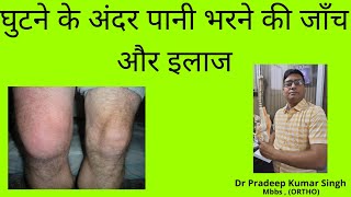 घुटने के अंदर पानी भरने की जाँच और इलाजKnee Effusion Test and TreatmentDr Pradeep Kumar Singh [upl. by Behlau]