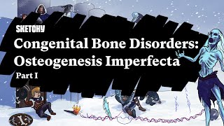 Congenital Bone Disorders Osteogenesis Imperfecta Part 1 of 2  Sketchy Medical  USMLE Step 1 [upl. by Yenobe]