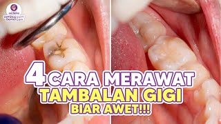 TAMBAL GIGI AWET BERAPA LAMA SIH  INI DIA 4 CARA MERAWAT TAMBALAN GIGI BIAR AWET [upl. by Flanna679]