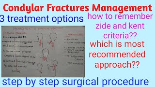 Condylar fractures management [upl. by Middle]