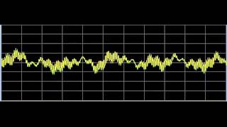 AntiAging 2 Skin Repair  Rife Frequencies [upl. by Lynelle]