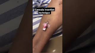 IV Cannula Insertion how To Insert IV Cannula doctor mbbs youtubeshorts ytshorts neet viral [upl. by Lorene130]