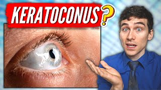 What is Keratoconus Keratoconus Eye Disease Explained [upl. by Oal]