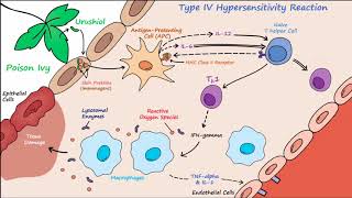 Type IV Hypersensitivity Described Concisely [upl. by Lebazej]