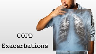 COPD Exacerbations [upl. by Aaron94]