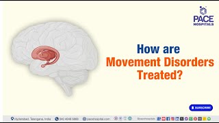 Treatment of Movement Disorder  How are Movement Disorders Treated  MovementDisorder [upl. by Eerihs]