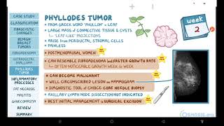 Benign breast conditions  pathology review  Osmosis [upl. by Massimiliano]