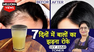 बालों का झड़ना जड़ से खत्म करें कितने भी खराब क्यों न हो नए बाल उगाये  Homemade Hair Growth Toner [upl. by Pietje]