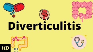 Diverticulitis Causes SIgns and Symptoms Diagnosis and Treatment [upl. by Ainalem69]