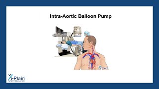 IntraAortic Balloon Pump [upl. by Atniuqal]