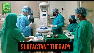 Surfactant administration of a premature babyA easiest way in NICU [upl. by Elamrej]