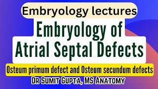 Atrial Septal Defects  Embryological basis [upl. by Ardnikal609]