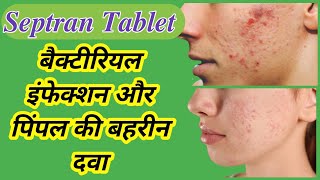 Septran DS Tablet Uses in Hindi  Septran DS  Treatment of pimples [upl. by Chemash]