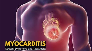 Myocarditis Causes Signs and Symptoms Diagnosis Treatment [upl. by Vizza]