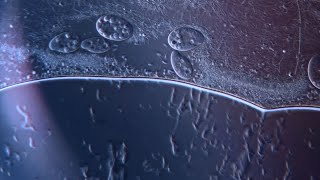 Ciliates feasting on Bacteria [upl. by Aitnwahs]