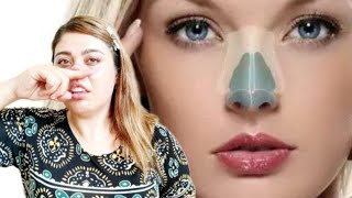 Nose Exercises To Slimmer amp More Beautiful in 1 Week  Top Exercises for Nose at Home [upl. by Kahn]