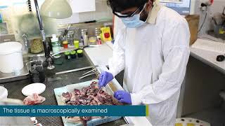 Training  Anatomical pathology processing of mesothelioma [upl. by Rockwood]