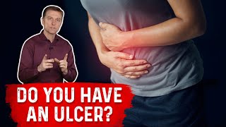 Understanding Ulcers How Do You Know If You Have One – Dr Berg [upl. by Patten]