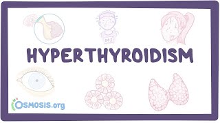 Hyperthyroidism  an Osmosis Preview [upl. by Kraft]