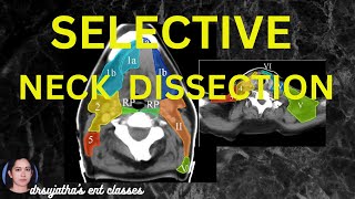 232Selective Neck Dissection  structures removed surgeryeducation dentallectures [upl. by Ardyce]