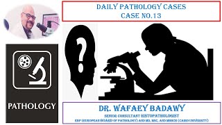 DAILY PATHOLOGY CASES CASE NO 13 BY Dr WAFAEY BADAWY [upl. by Jack]