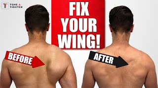 FIX Scapular Winging with Shoulder Blade Exercises [upl. by Chloris681]