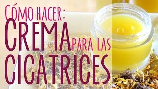 Crema casera para las cicatrices [upl. by Seleta]