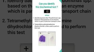 Quiz6Biochemical test for identification of bacteriashorts shortsfeed basicappliedmicrobiology [upl. by Eceerehs14]