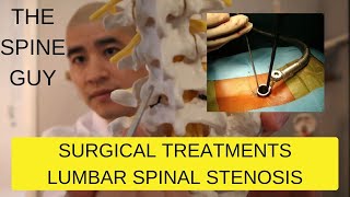 Part 3  Surgical Treatments for Lumbar Spinal Stenosis [upl. by Notnerb650]