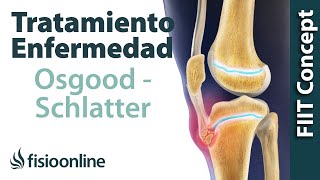 Tratamiento de las crecederas o enfermedad OSGOOD SCHLATTER [upl. by Imray50]