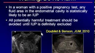 Part1 Sonography of the 1st Trimester Another Look Oksana H Baltarowich MD [upl. by Carnay]